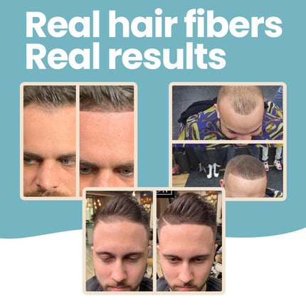 Hair Fibers & Holding Spray for Bald Spot Concealer, Hairline, Beard, Hair Loss