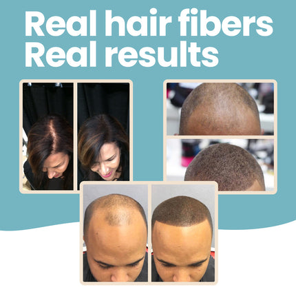 Hair Fibers & Holding Spray for Bald Spot Concealer, Hairline, Beard, Hair Loss