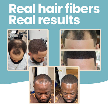 Hair Fibers & Holding Spray for Bald Spot Concealer, Hairline, Beard, Hair Loss
