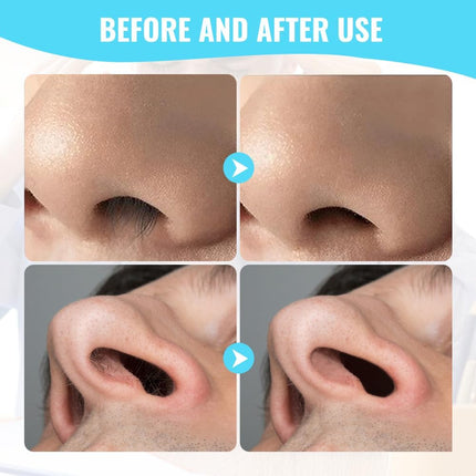 2 in 1 Nose Hair Trimmer – Double-Sided Manual Nose & Ear Grooming Tool, 360° Rotating, Portable, 3-Pack (Blue)