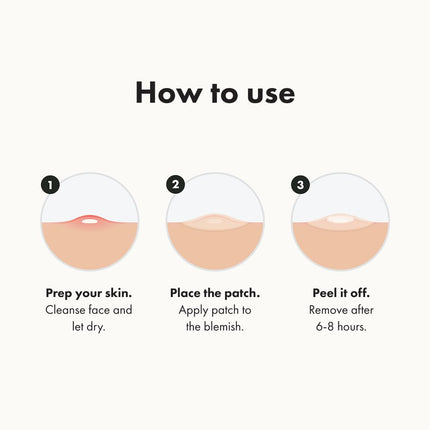 Original Acne Pimple Patches – Hydrocolloid Spot Stickers for Zits & Whiteheads, Overnight Blemish Care, 36 Count