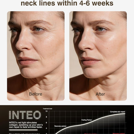 INTEO Red Light Therapy Face & Neck Mask – LED Light Therapy Mask with 4 Light Modes