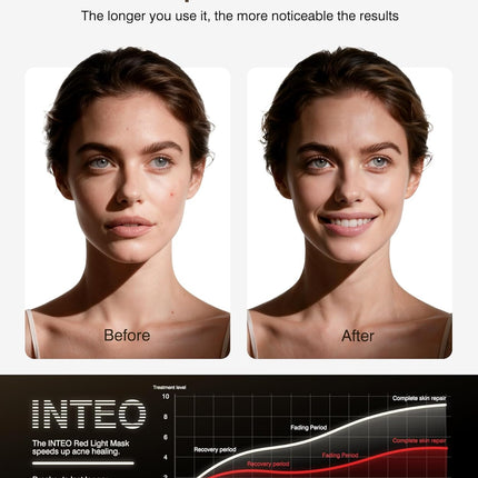 INTEO Red Light Therapy Face & Neck Mask – LED Light Therapy Mask with 4 Light Modes