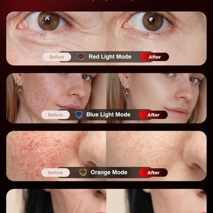 INTEO LED Light Therapy Face Mask – 4-Mode Facial Mask with Red, Blue, Orange & Near-Infrared Light