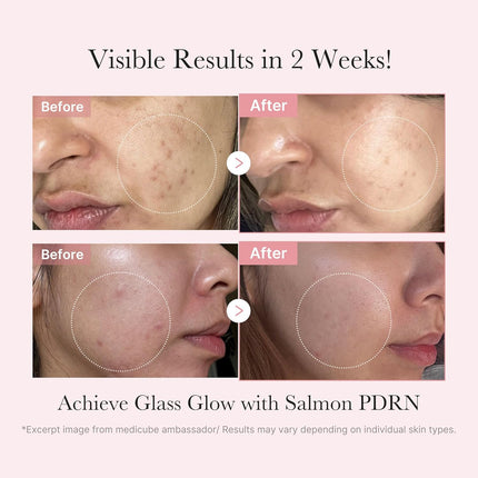 Salmon DNA PDRN Trial Kit